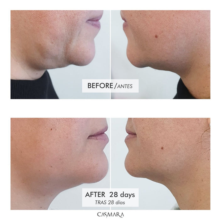 Crema Reestructurante Tense-Lift 100ml - Casmara - 3